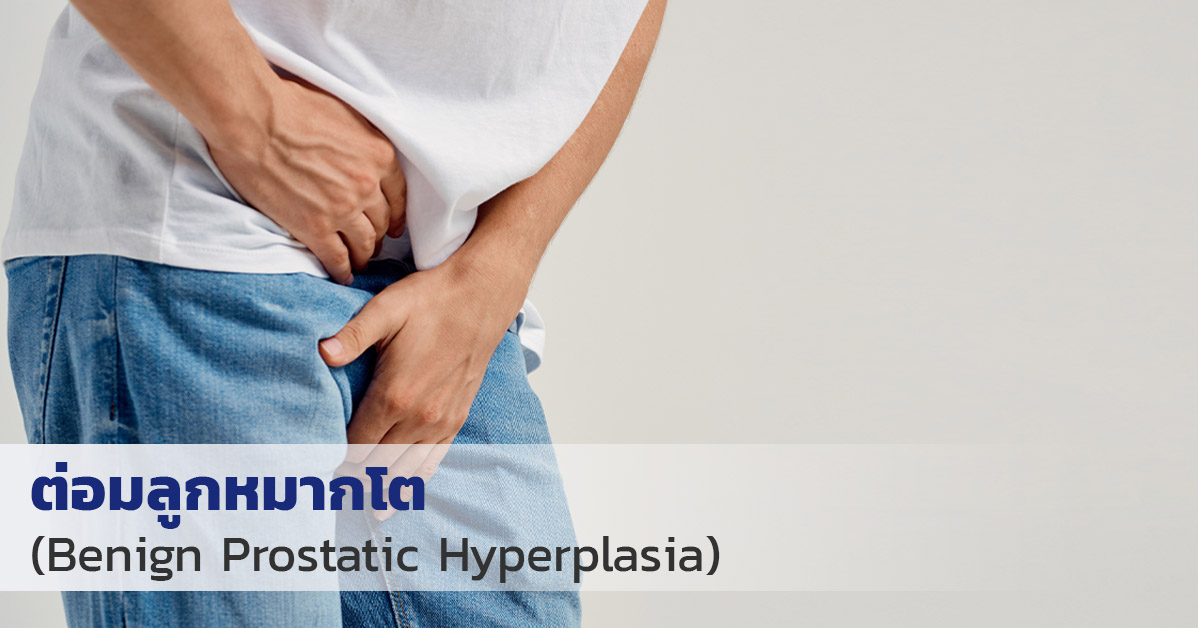 ต่อมลูกหมากโต (Benign Prostatic Hyperplasia)