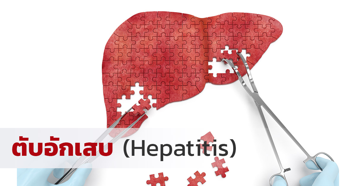 ตับอักเสบ (Hepatitis)