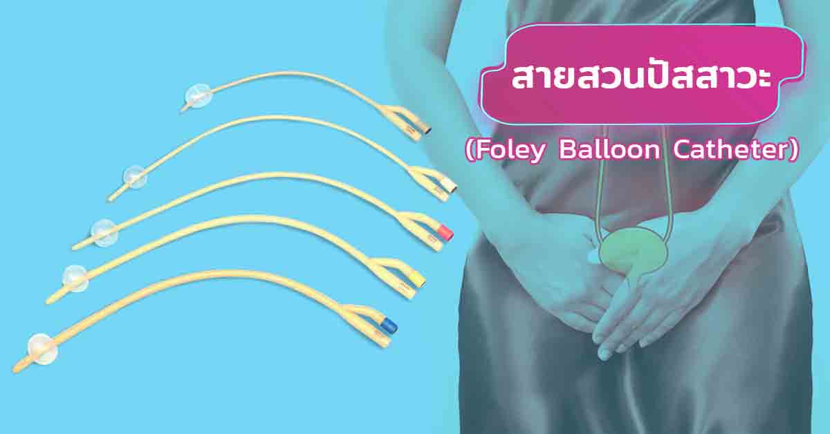 สายสวนปัสสาวะ (Foley Balloon Catheter)