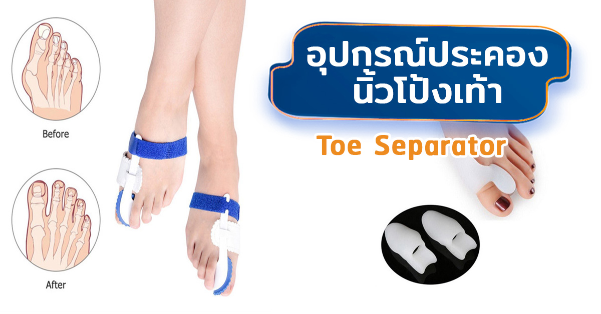 อุปกรณ์ประคองนิ้วโป้งเท้า (Toe Separator)