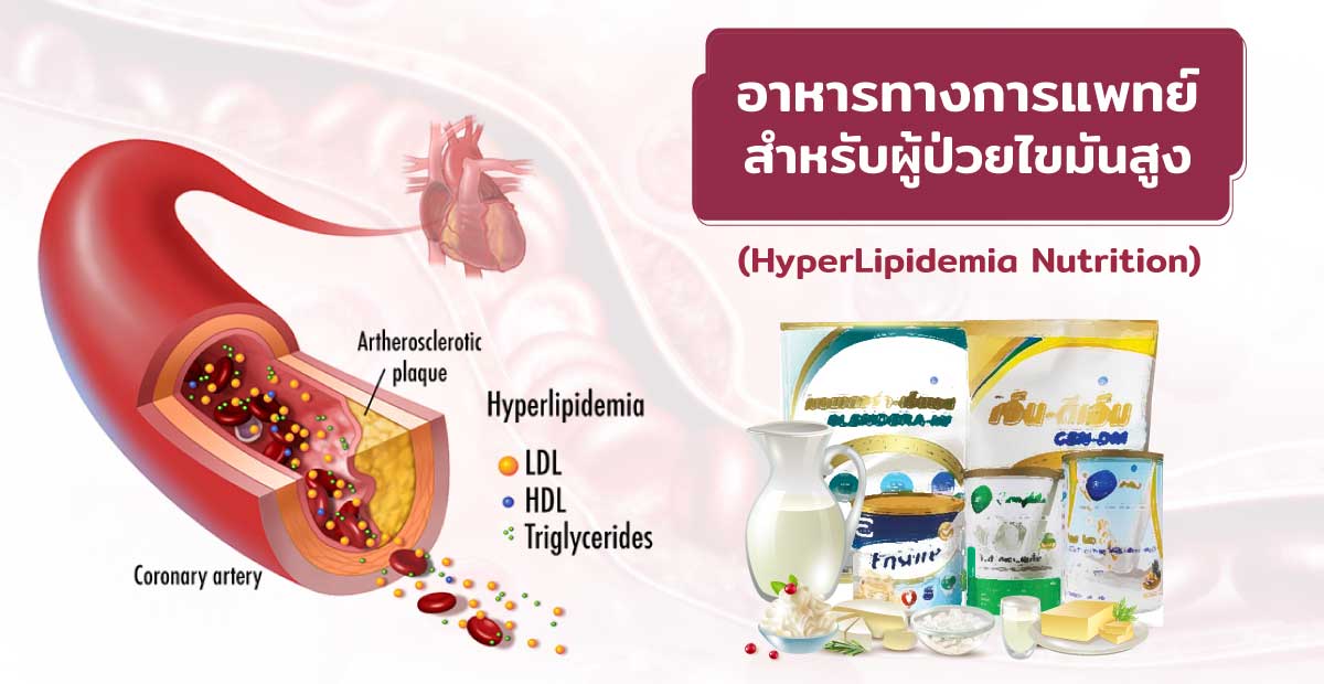 อาหารทางการแพทย์สำหรับผู้ป่วยไขมันสูง (HyperLipidemia Nutrition)