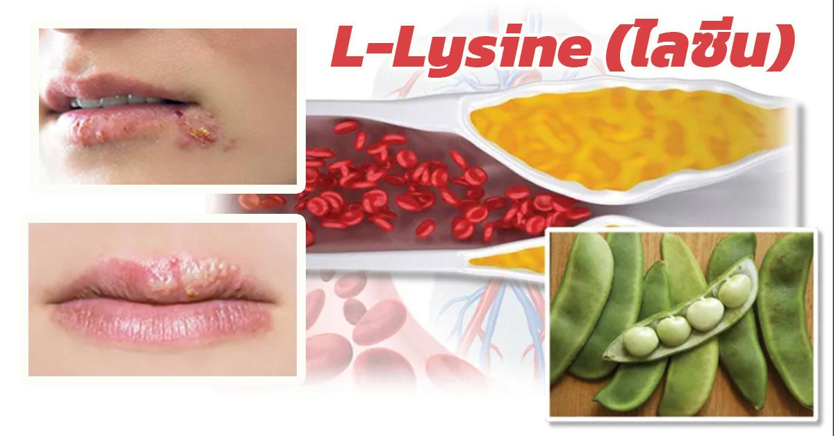 ไลซีน L-Lysine 